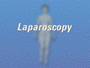 Your doctor has recommended a laparoscopic surgical procedure either to aid in diagnosis