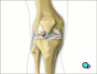... in order to expose the damaged knee joint.